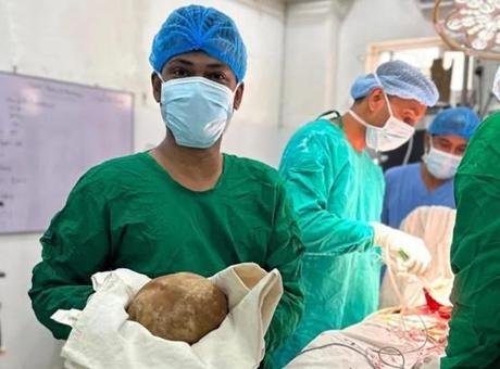 Sri Lanka’da Rekor Kıran Ameliyat: 3 Kilo Ağırlığında Mesane Taşı Çıkarıldı